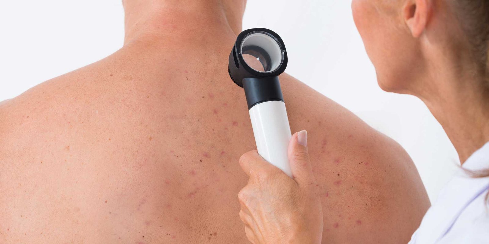 ¿Por qué ver un dermatólogo certificado?